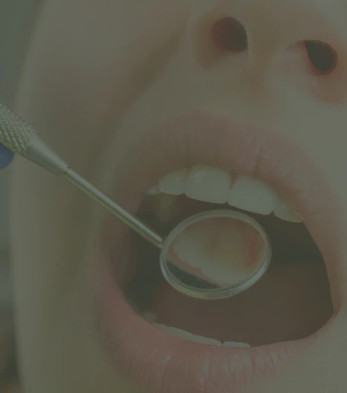 A dentist uses a small mirror to examine a patients teeth.