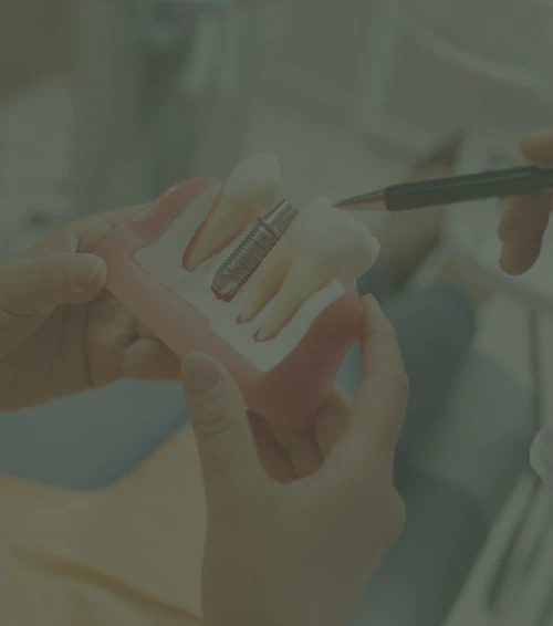 A dentist holding a dental model showing a tooth implant procedure, pointing with a pen.